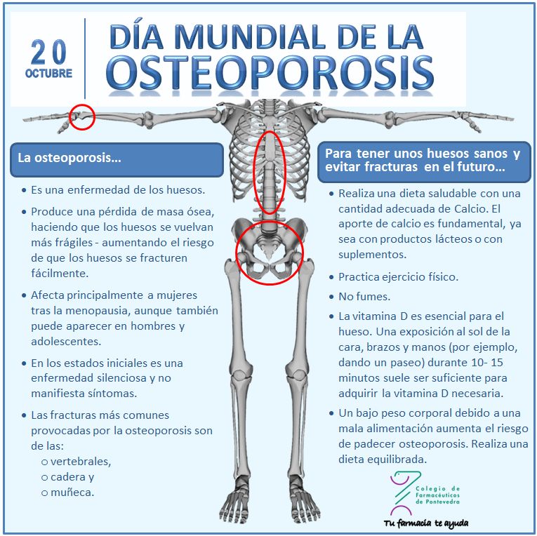 Día Mundial de la Osteoporosis 2017 - Colegio de Farmacéuticos de Pontevedra